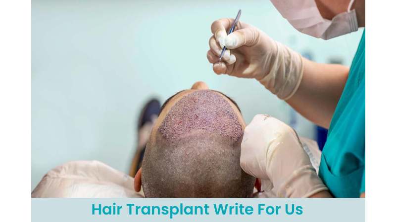 Hair Transplant Write For Us