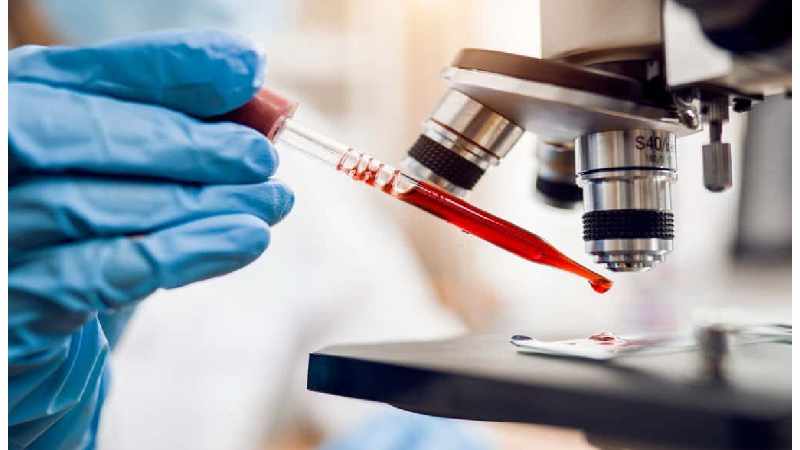 Rajkotupdates.News: Emm-Negative-Rare-Blood-Group-Found-In-Rajkot-Man-11th-Such-Case-Worldwide