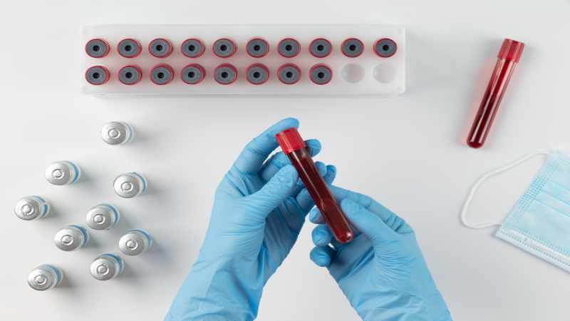 Rajkotupdates.News: Emm-Negative-Rare-Blood-Group-Found-In-Rajkot-Man-11th-Such-Case-Worldwide
