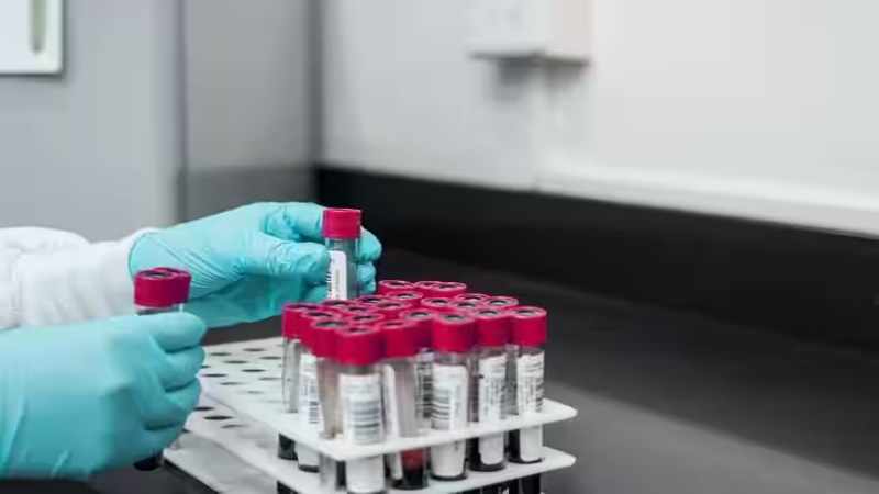Rajkotupdates.News: Emm-Negative-Rare-Blood-Group-Found-In-Rajkot-Man-11th-Such-Case-Worldwide