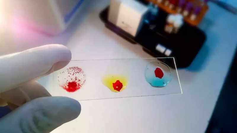 Characteristics Of Emm-Negative Blood